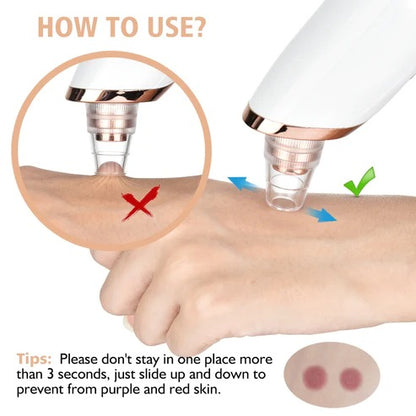 Electric Blackhead Remover - NextMamas