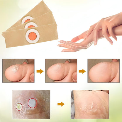 Foot Corn Pads – Remove Corns Quickly, Cushion Against Pressure - NextMamas